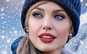 玻尿酸豐唇----奧斯丁NeoSoma專業醫美讓您的顔值瞬間上升一個檔次！