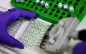 美國成功完成人類膀胱移植 創世界首例